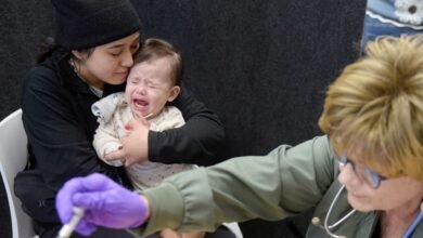 حالات الإصابة بمرض الحصبة في الولايات المتحدة تتجاوز 700