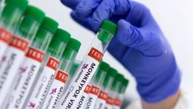 غانا تسجل 45 إصابة مؤكدة بفيروس جدري القرود خلال شهر واحد