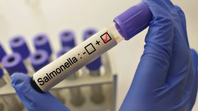 تفشي السالمونيلا في سبع ولايات أمريكية